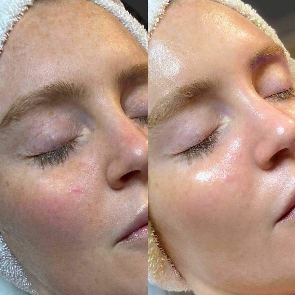 Spa Face Treatments
